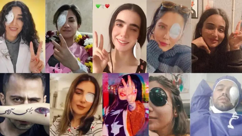 Hêzên Îranê zêdetirî 120 ciwan kor kirin