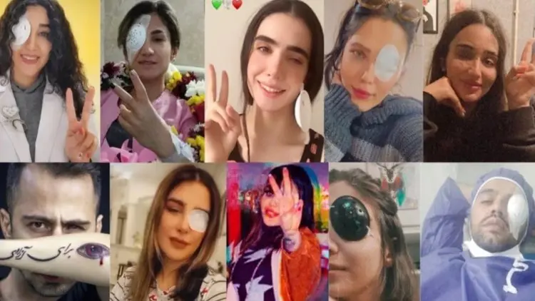 Jina Emini olaylari | Iran, 120’den fazla protestocuyu bilinçli olarak kör etti!