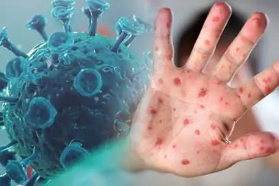 Avrupa'dan dikkat çeken M çiçegi uyarisi!