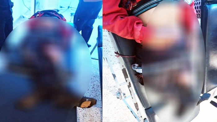 Rojava | Di teqîna mayînê de 2 zarokan can da