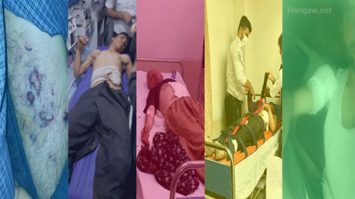 Li Rojhilatê Kurdistanê 10 kolberên Kurd hatin birîndarkirin