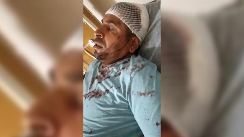 Karkerê Kurd Esat Atabey rastî êrîseke nijadperestî hat