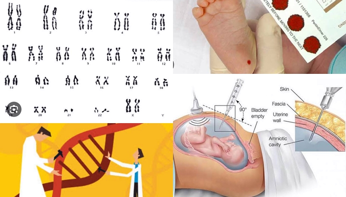 Mezinbûna girêka ser gurçikê bi pitikan re