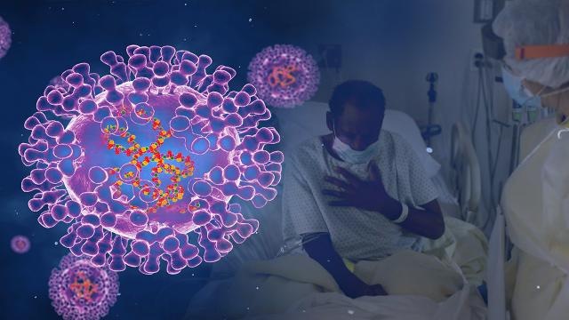 WHO: Hejmara pêketiyên Sewba Monkeypoxê, gihîst 257an