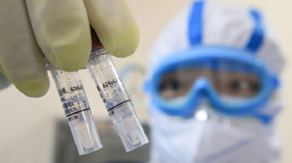 RDIF: Rusya birçok ülkeye yardimci olacak, 30 dakikada sonuç alinacak