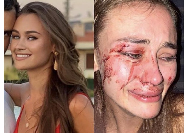 Güvenlik görevlileri Izmir'e tatile gelen dünyaca ünlü modeli feci sekilde darp etti!