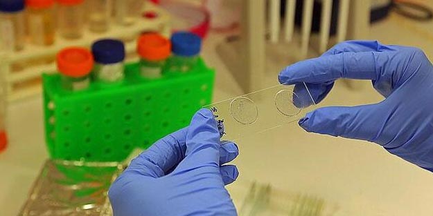 Li Çînê vîruseke din peyda bû: Ji Bunyavîrusê 7 kes mirin