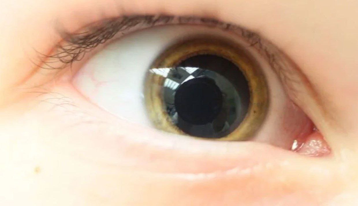 توێژەران : قەبارەی گلێنەکانی چاوت دەتوانێت نهێنیەکی گرینگ دەربارەی تواناکانی مێشکت ئاشکرا بکات