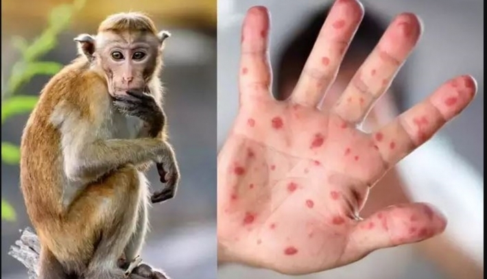 تەندروستیی جیهانی: "لە هەفتەی ڕابردوودا نزیکەی حەوت هەزار و ٥٠٠ حاڵەتی نوێی تووشبوون بە ئاوڵەی مەیموون تۆمارکراوە"