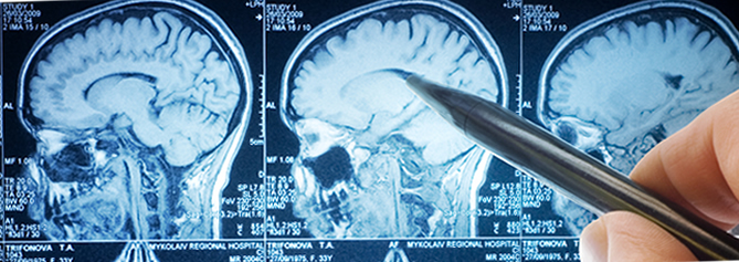 ١٠ هۆکاری سەرەکی کە تواناکانی مێشک لاوازتر دەکەن