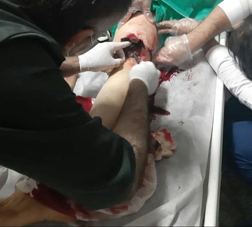 کۆڵبەرێک بە تەقەی ڕاستەوخۆی هێزە چەکدارەکانی ئێران بە سەختی بریندار دەکرێت