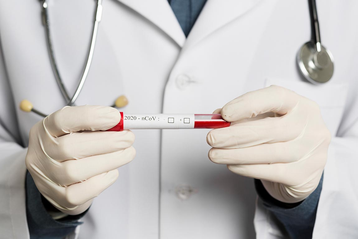 پسپۆڕانی بواری تەندروستی هۆشداری پشکنینی ڤیرووسی کۆرۆنا دەدەن لەم ڕێگایەوە