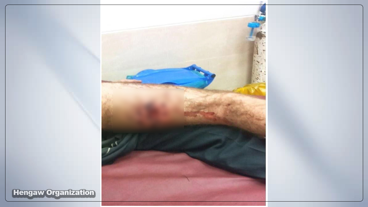 کۆڵبەرێکی مێرمنداڵ لە سنووری نەوسوود بریندار کرا